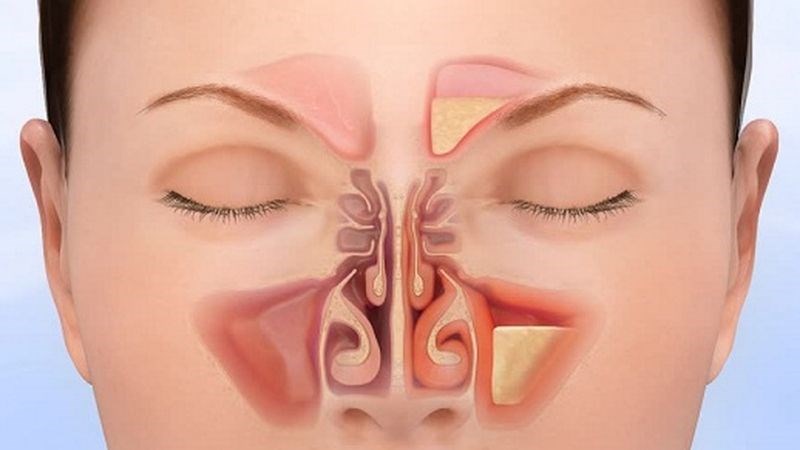 Bấm huyệt đạo giảm nghẹt mũi